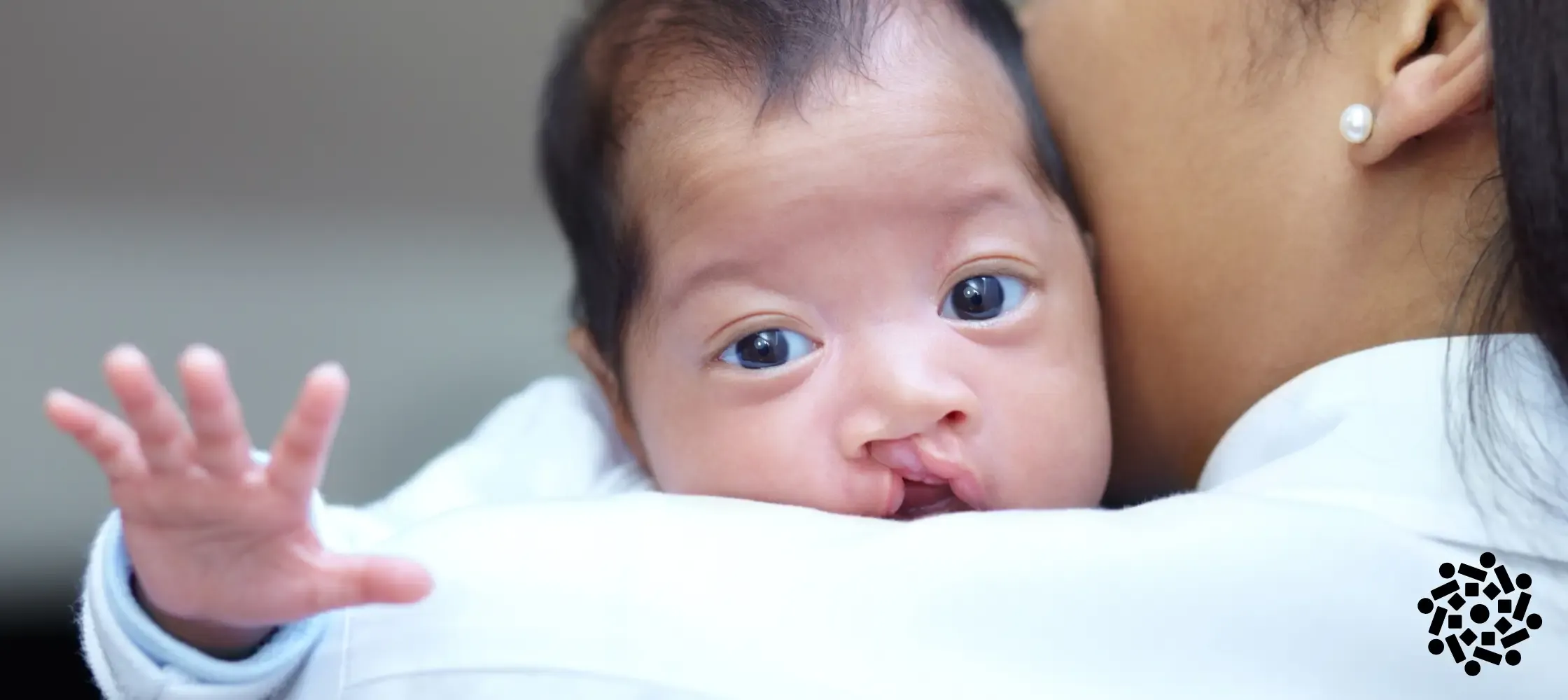 Fenda palatina: uma marca para se curar