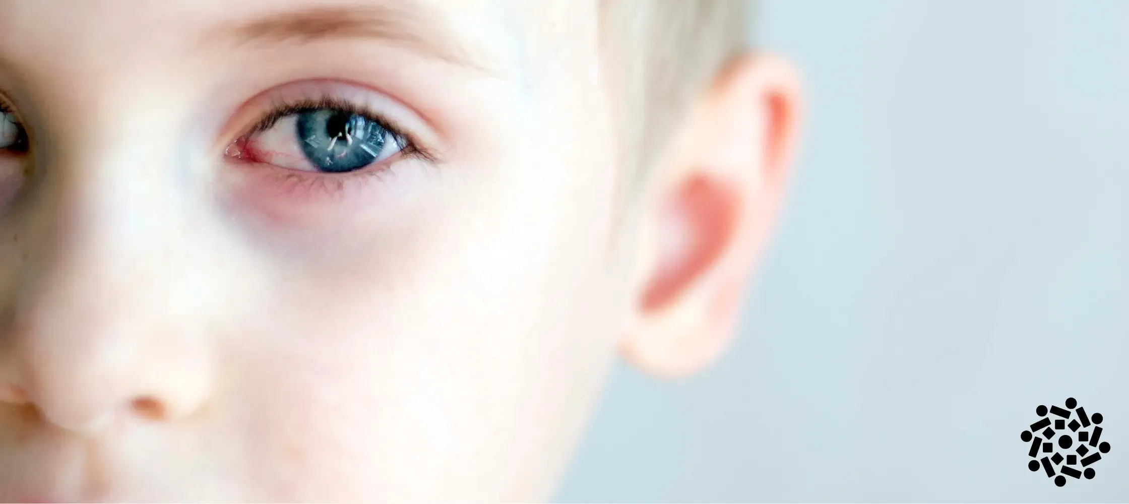 Olhos vermelhos na piscina: por que isso acontece?