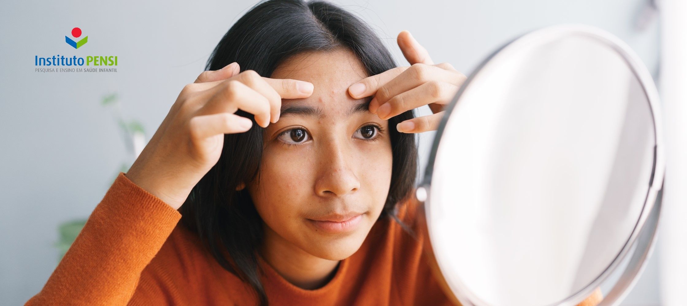 O que piora a acne na adolescência?